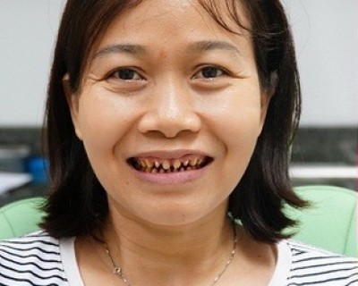 Chị Quyến ( Bình Thạnh)