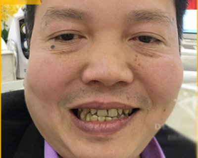 Anh Vương